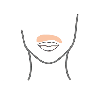 Upper lip t